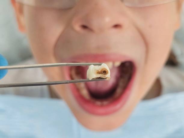 Best Emergency Pediatric Dentist  in Stockton University, NJ