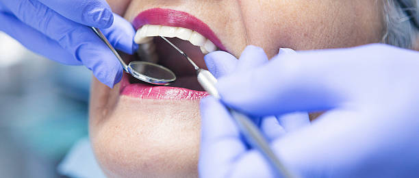 Best Urgent Tooth Repair  in Stockton University, NJ